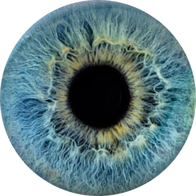 Auge mit Kontaktlinse